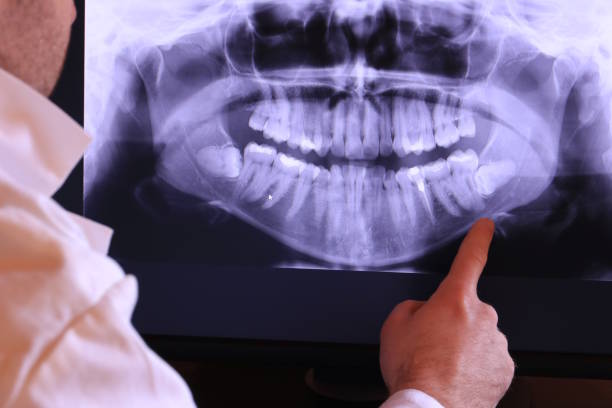 Best Weekend Emergency Dental Services in Lipatria, CA
